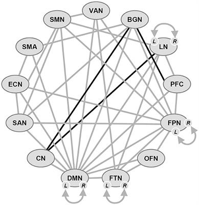 Mild cognitive impairment in Parkinson's disease: current view